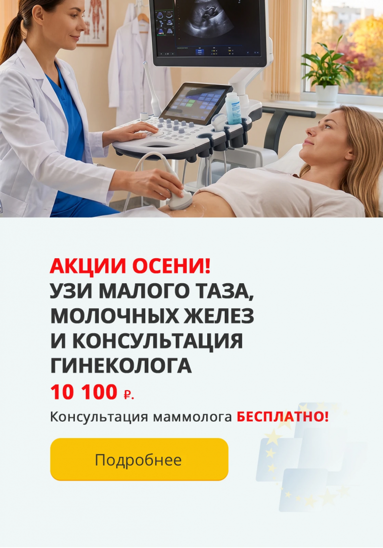 Узи за 10100
