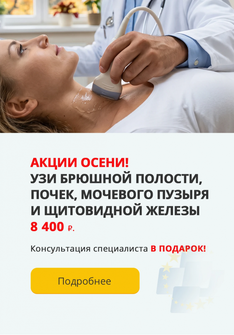 Узи за 8400